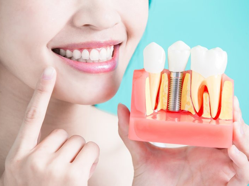 cong-nghe-cay-ghep-implant-hien-dai-o-uni-dental