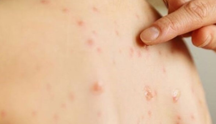 ban-soi-co-ngua-khong-giai-dap-chi-tiet-va-huong-dan-cham-soc-dung-cach